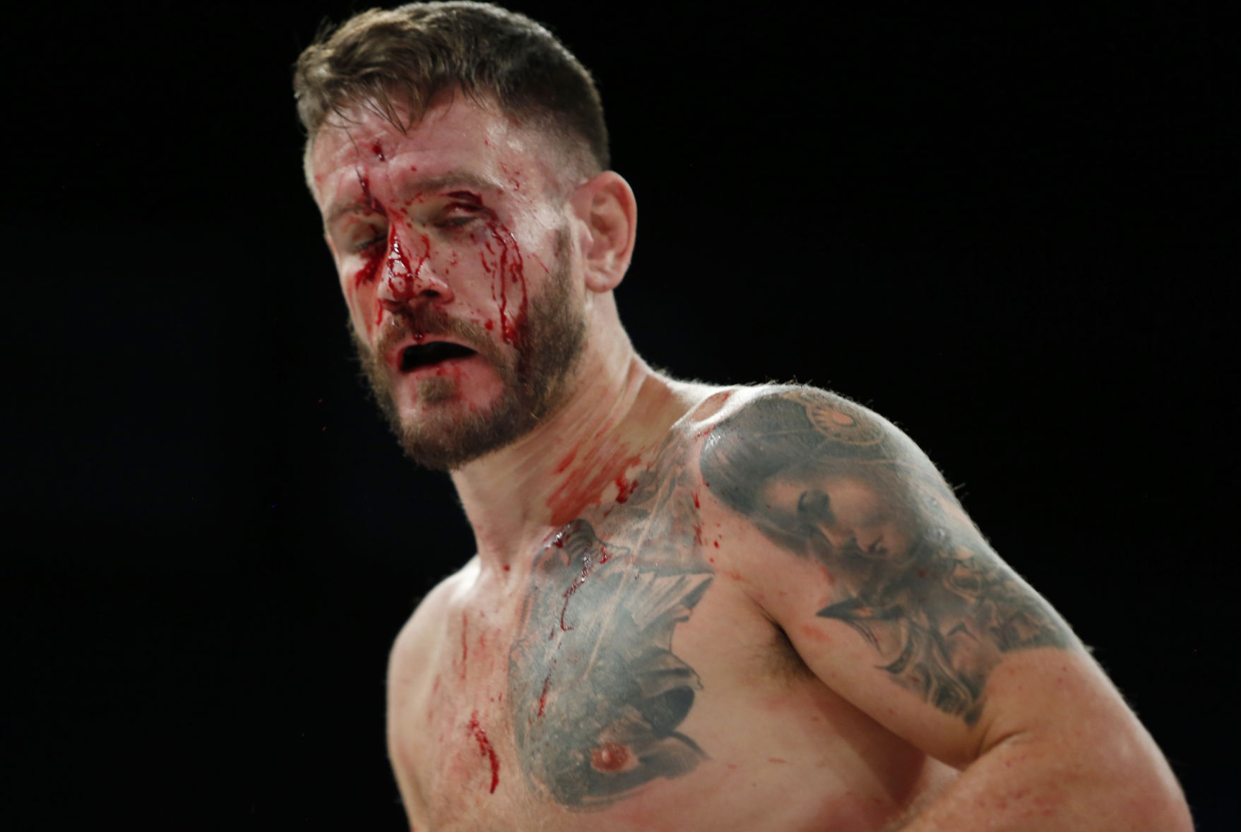 Bare Knuckle Boxing